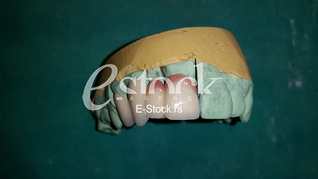 Zubna proteza Teeth