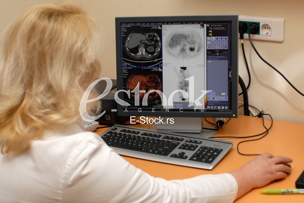  PET scanner 