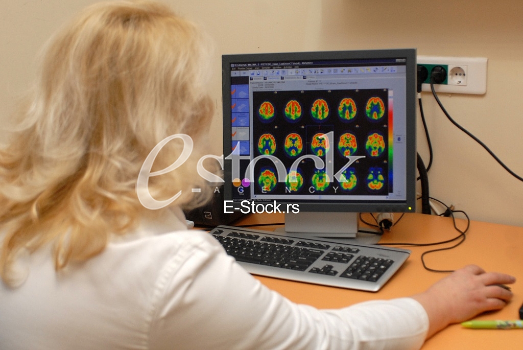  PET scanner 