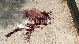 Wounded owner of Octopus Hobotnica