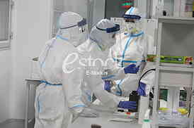 Vatreno oko laboratorija