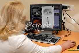  PET scanner 