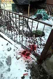 suicide attempt,